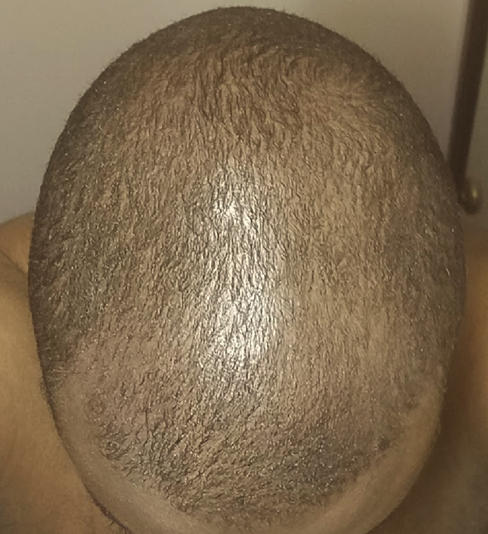 1 Week Start May 2018.png