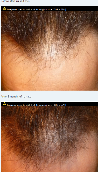 1247171089_ascru.png.2199b95195dc31527e764be25cd61683.png