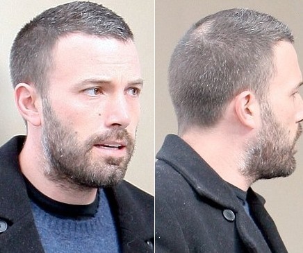 2010-ben-affleck-bald.jpg