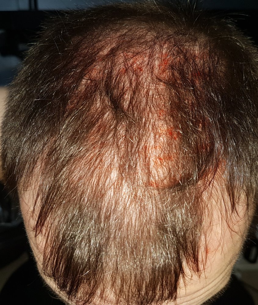 20180305_144413 (1).jpg