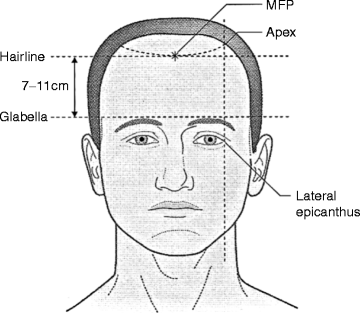 212233_1_En_13_Fig6_HTML.gif