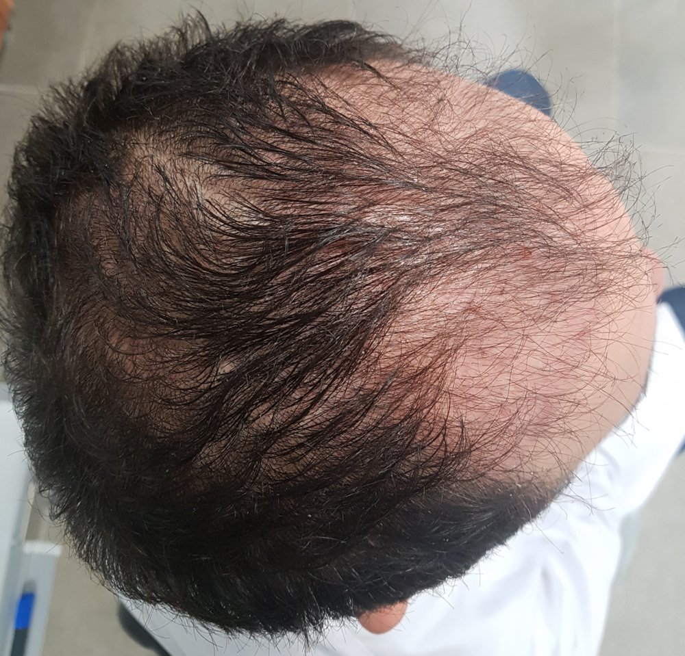 25aralık18 kesilmiş.jpg