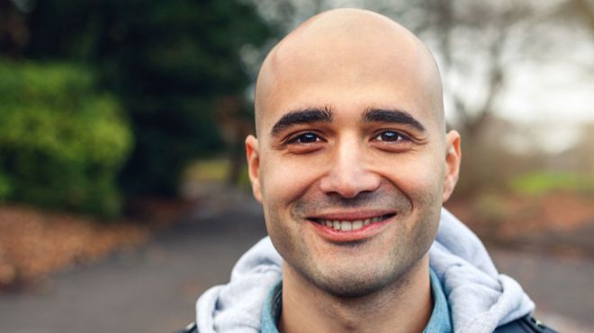 _101231984_bald_man_getty.jpg