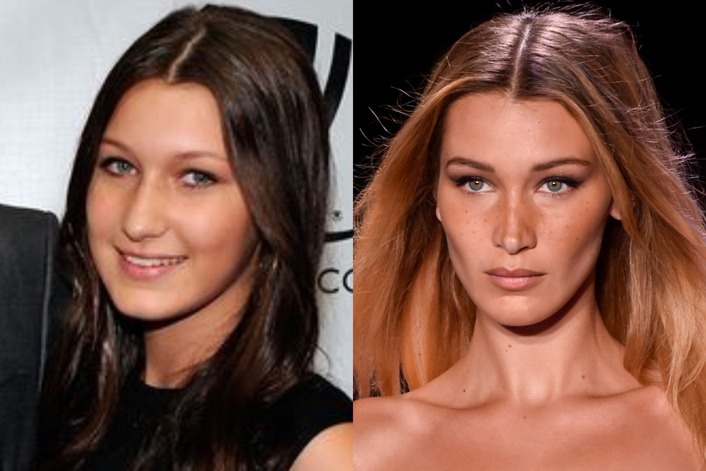 a-hadid-before-and-after-plastic-surgery-1500-1000.jpg