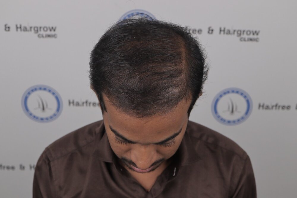 after 4 month result.JPG