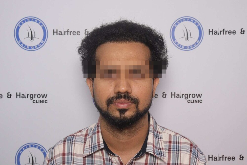 after 6-8 month result_anonymized.jpg