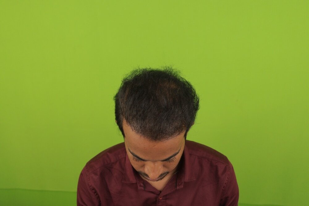 after 9 month result.JPG