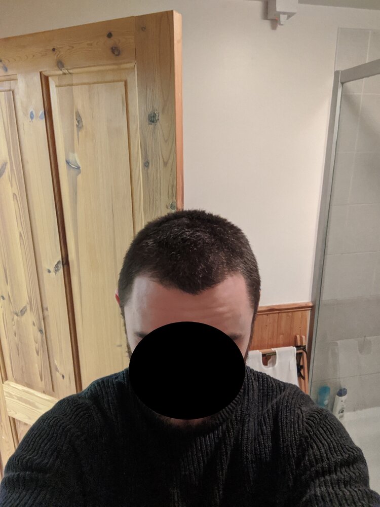 after.jpg