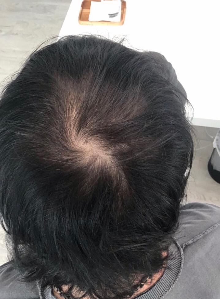 Aug 19 - hair.jpg