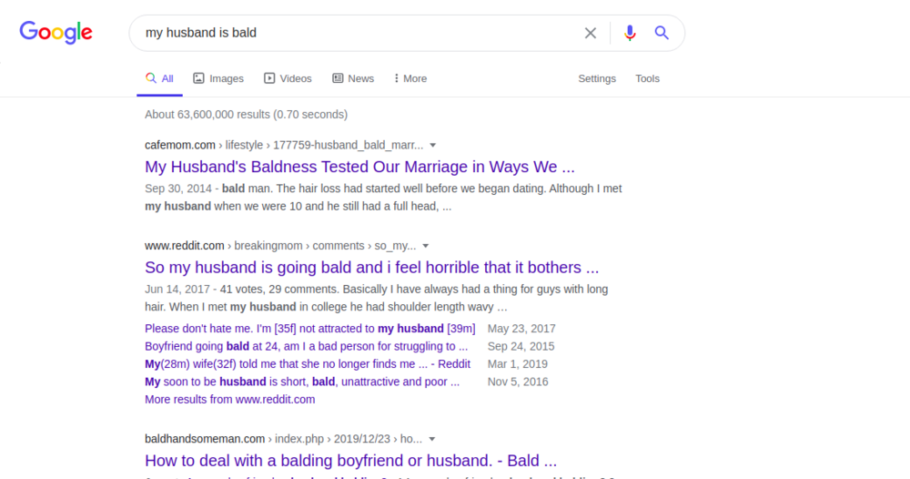 bald-1.png