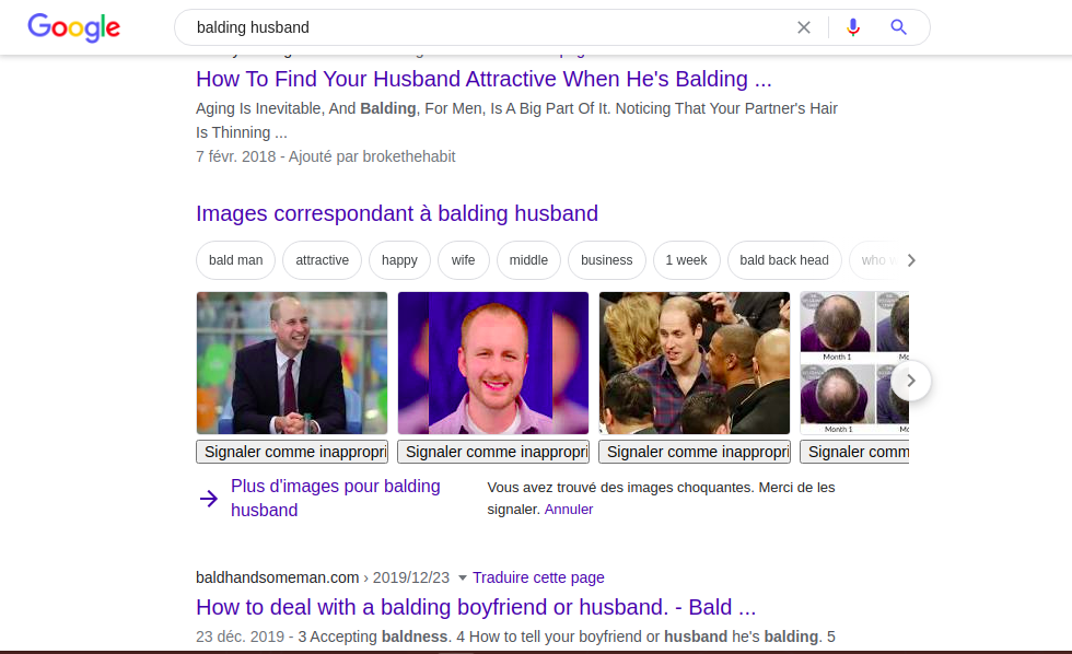bald-2.png