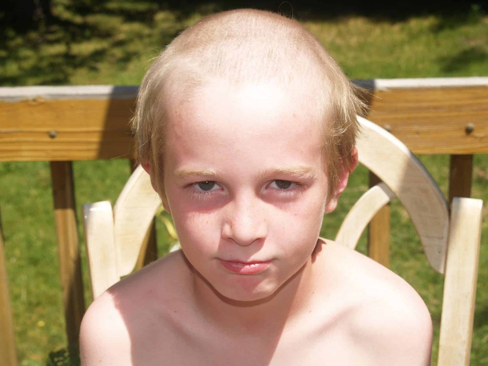 bald-kid.jpg