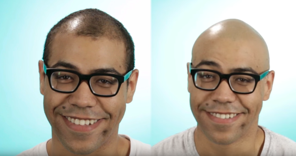 balding1.png