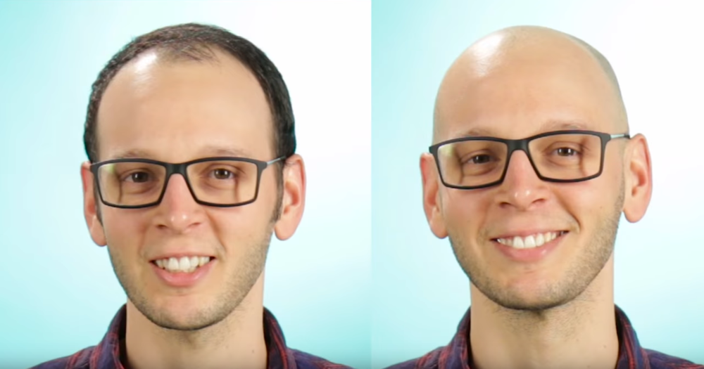 balding2.png