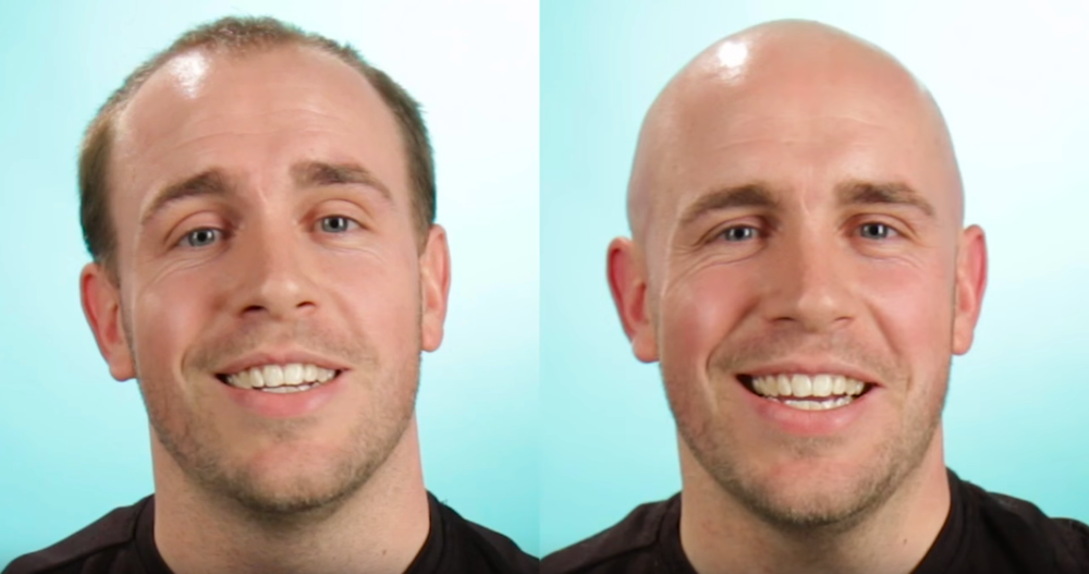 balding3.png