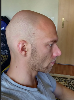 Baldwhiteguy2.png