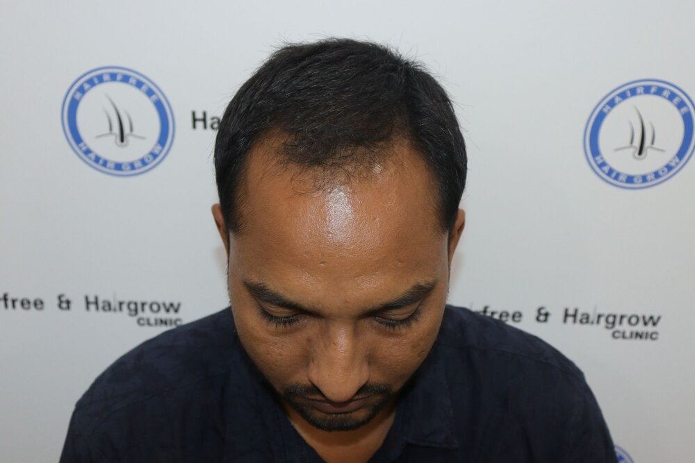 before transplant.JPG