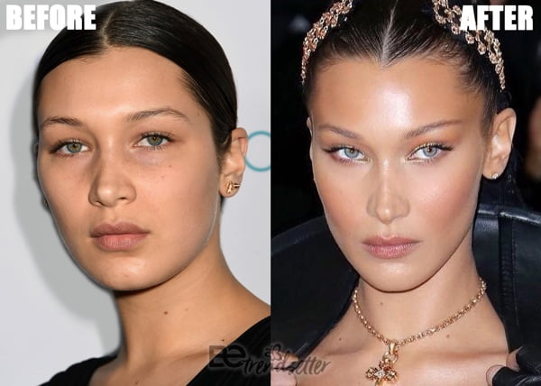 bella-hadid-plastic-surgery-2019.jpg