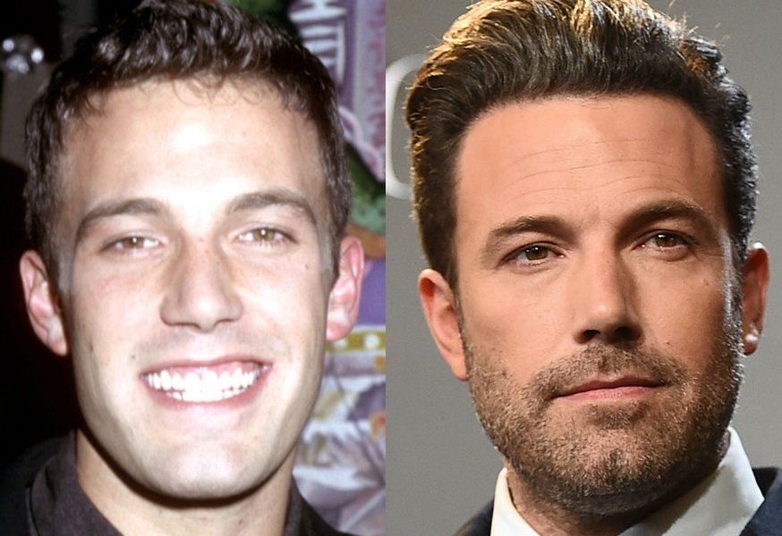 Ben-Affleck-before-after-hair.jpg