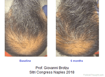 Brotzu-Male.png
