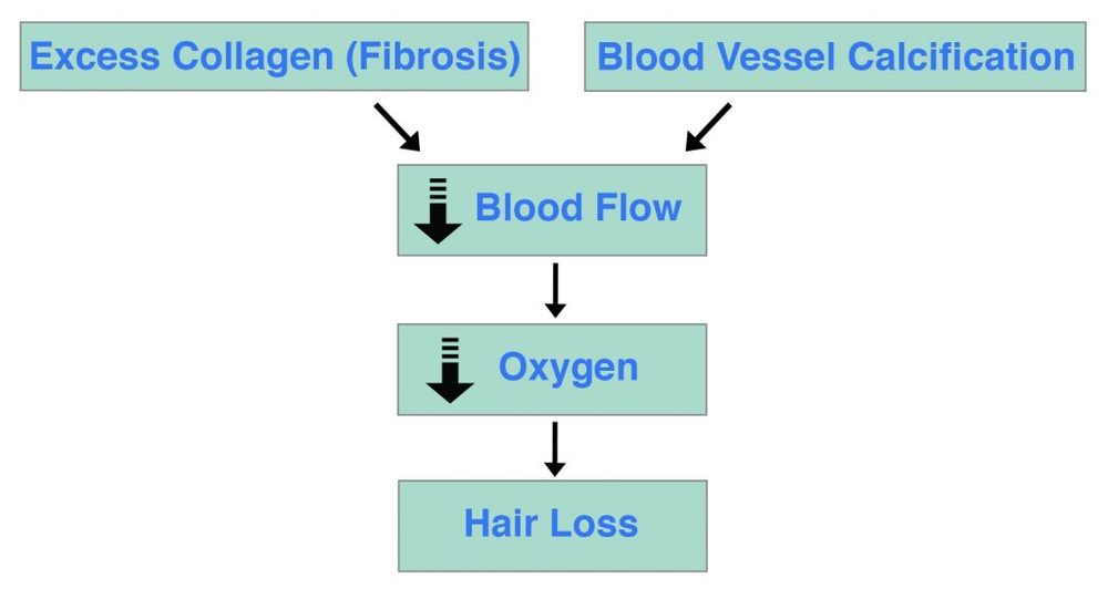 Calcification-Fibrosis-Hair-Loss-1024x545.jpg