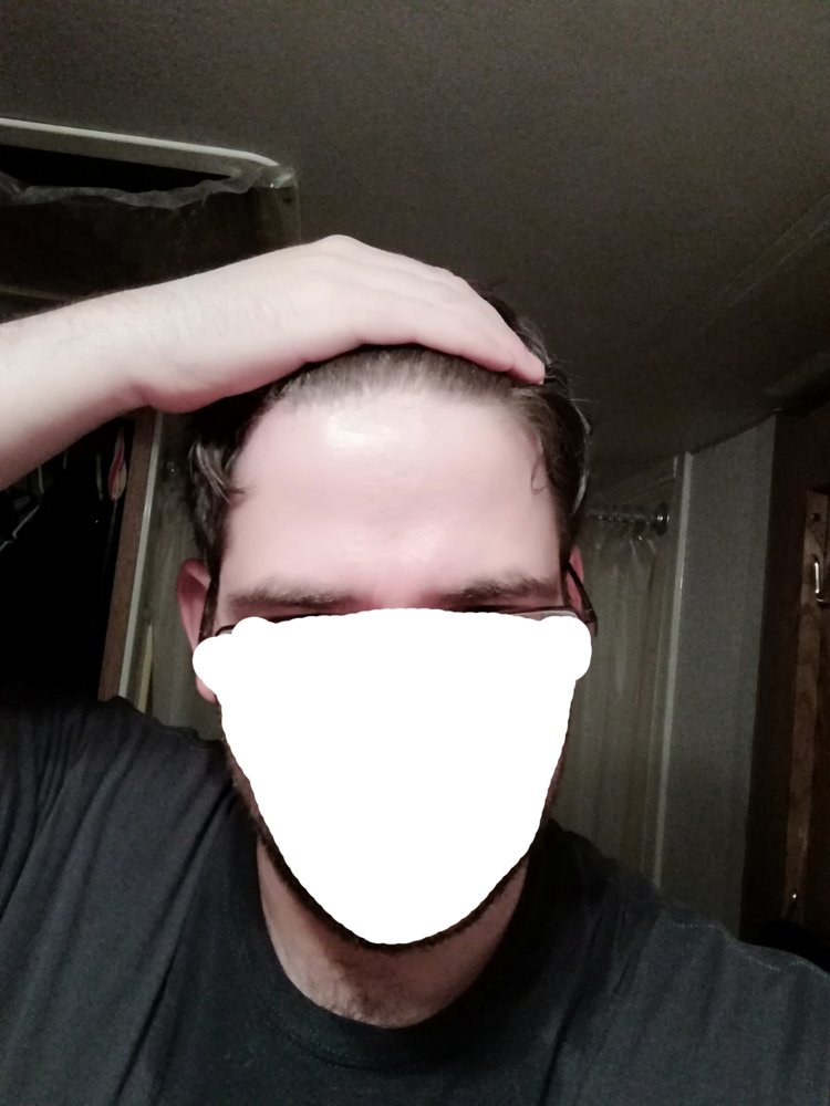 Day -1 Front Pull.jpg