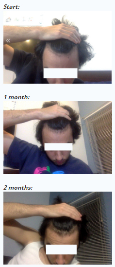 dYZ1AWZ.png