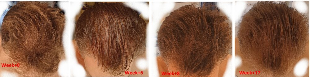Evolution_s0_s18_cheveux_apres_douche.jpg