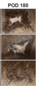 FAK-Inhibitor-Hair-Growth-126x300.png