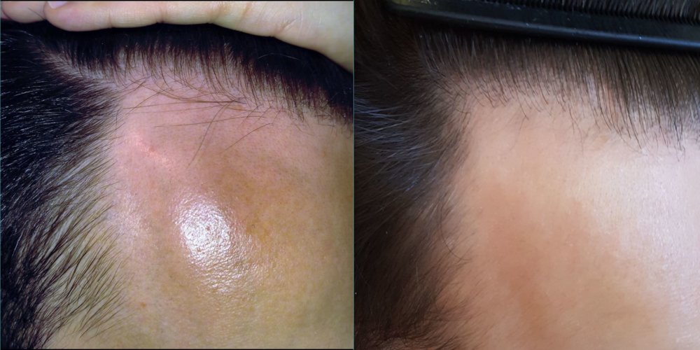 Feb 2016 vs Oct 2017.JPG