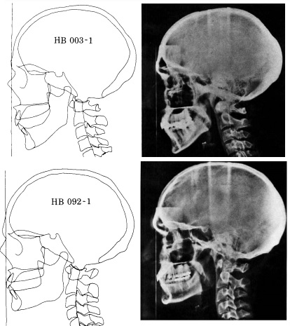 fhprx.jpg