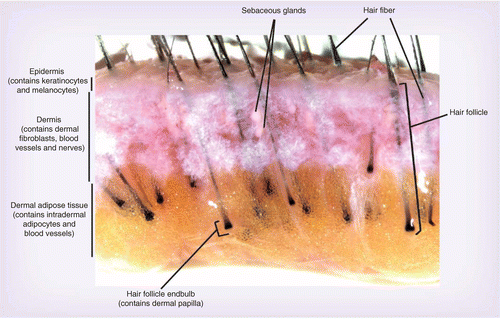 figure1.gif