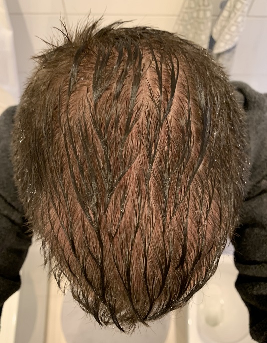 Före.2.jpg