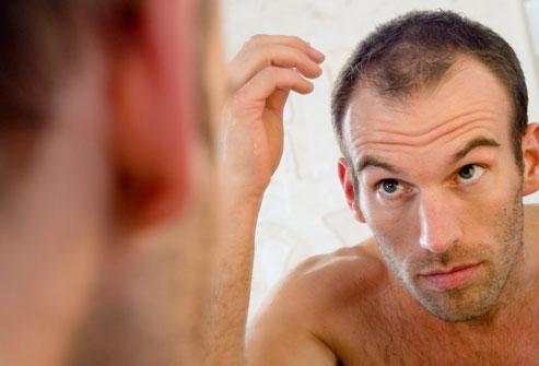 getty_rf_photo_of_balding_man_in_mirror.jpg