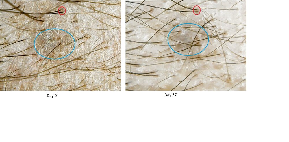 grain de beauté compair VS day 0.jpg