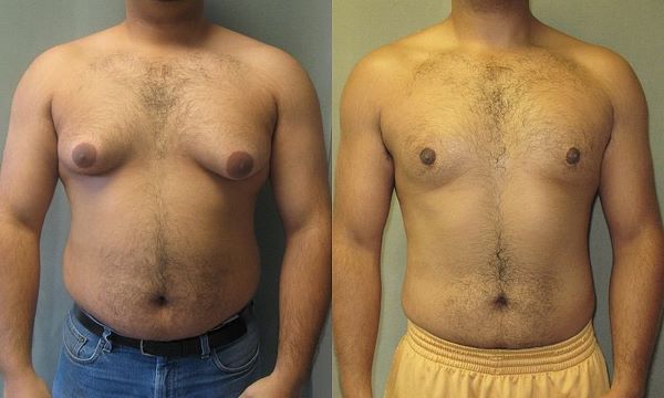 gyno.jpg