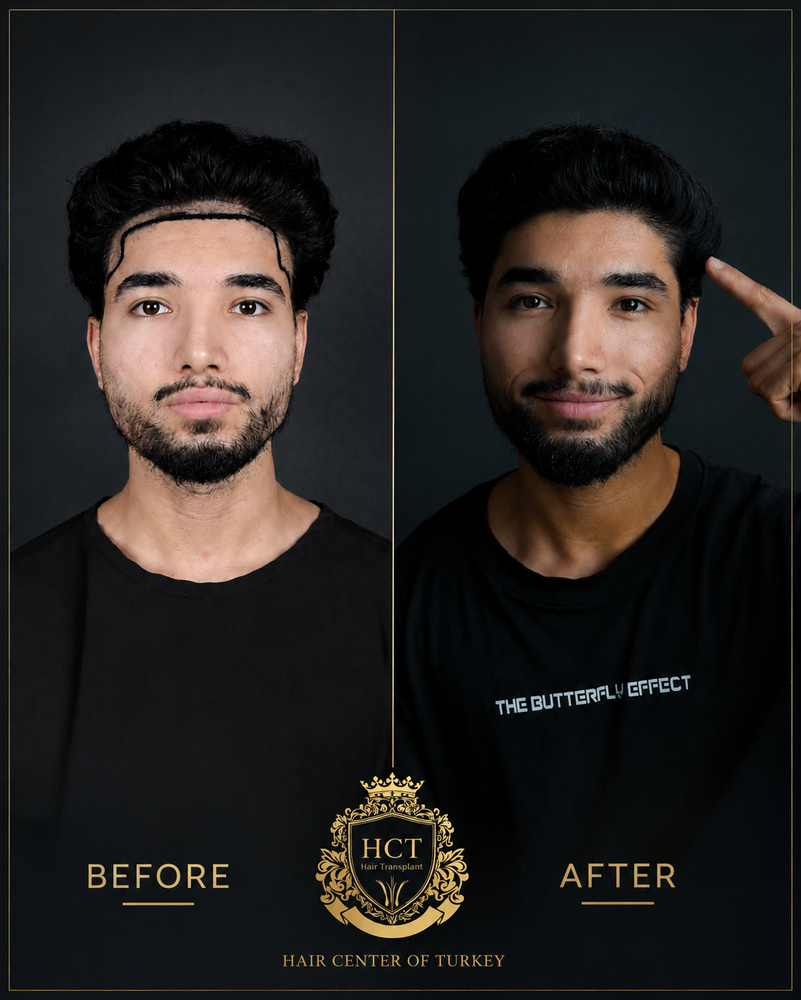 hair center of turkey.png