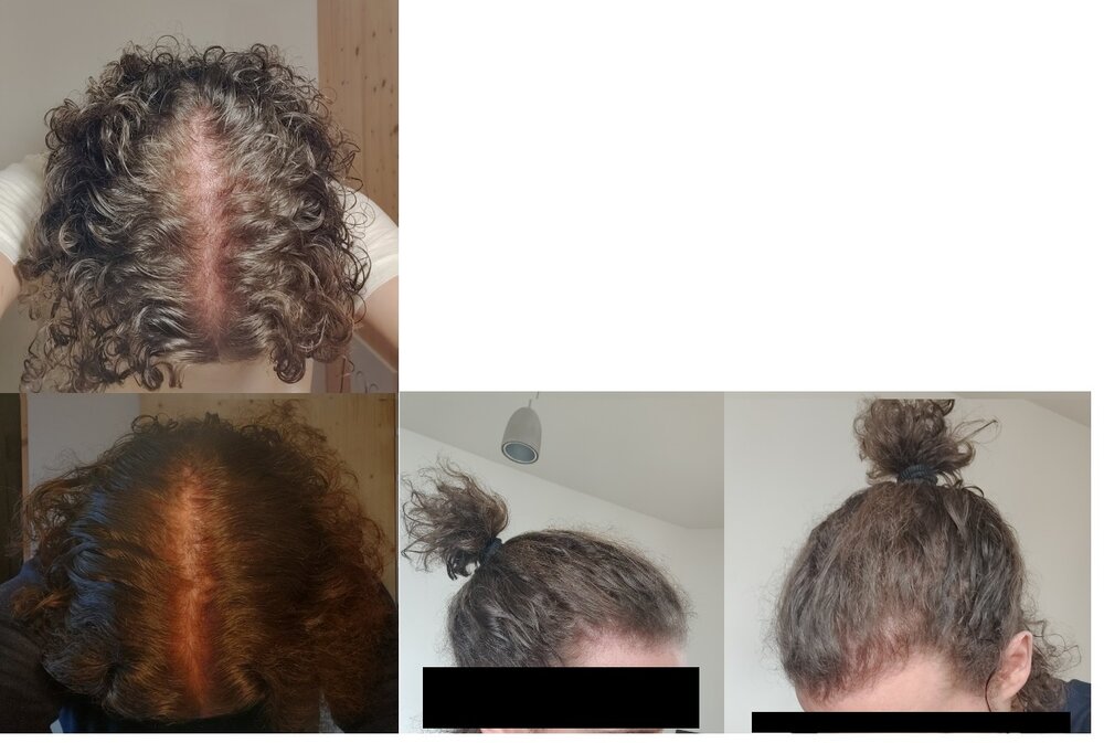 Hair.jpg