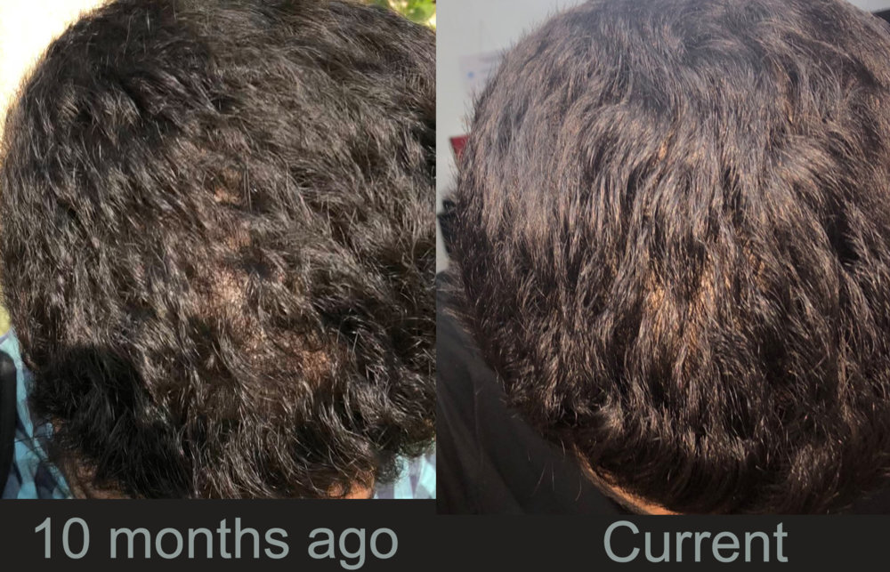 hair-side-by-side.jpg