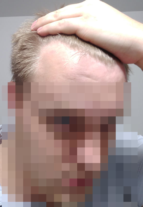 hair update.jpg