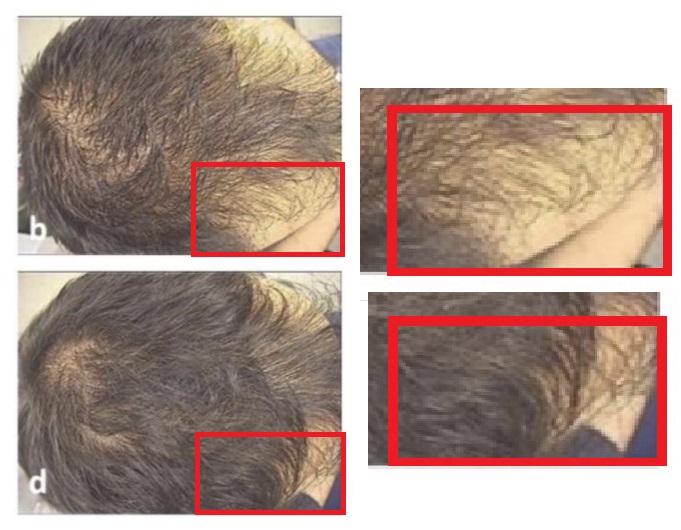 Hair2.jpg