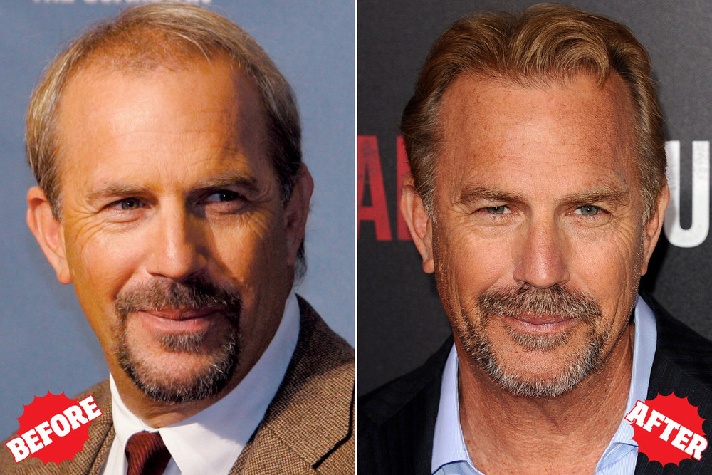 hair_costner_before_after1a.jpg