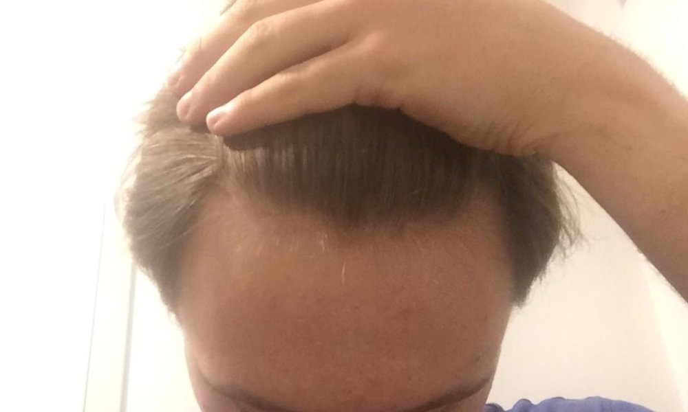 hairline.jpeg