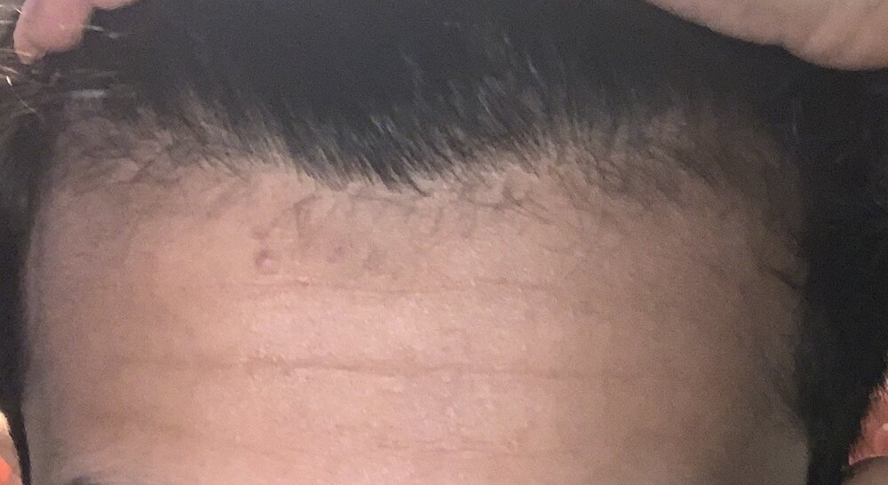 hairline.jpeg