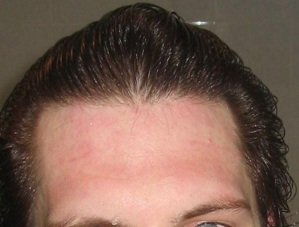 HairLossTalk.com 1 - Kopie.jpg