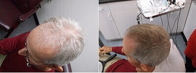 Hemp-Extract-Before-and-After-Hair-Growth.jpg