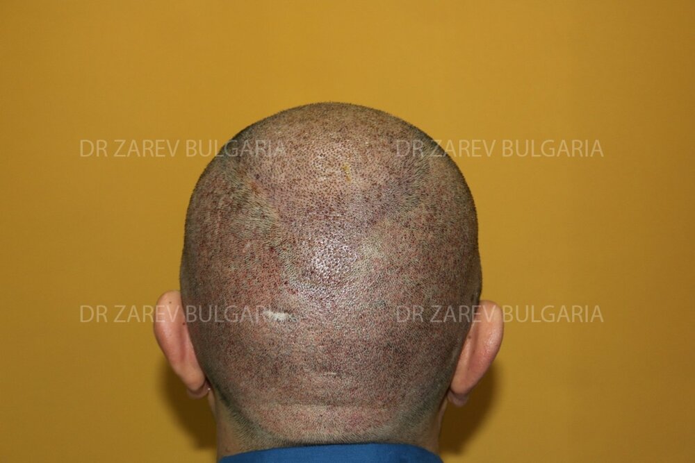 image.php?&mode=full&folder=11700Grafts&file=j8.jpg