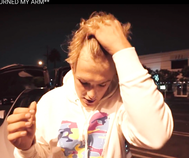 JakePaulHairline-608x510.png