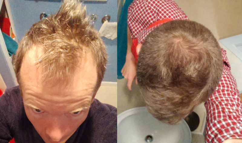 jdbeforeafter.jpg