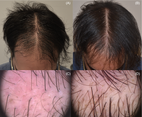 jocd13061-fig-0002-m.png